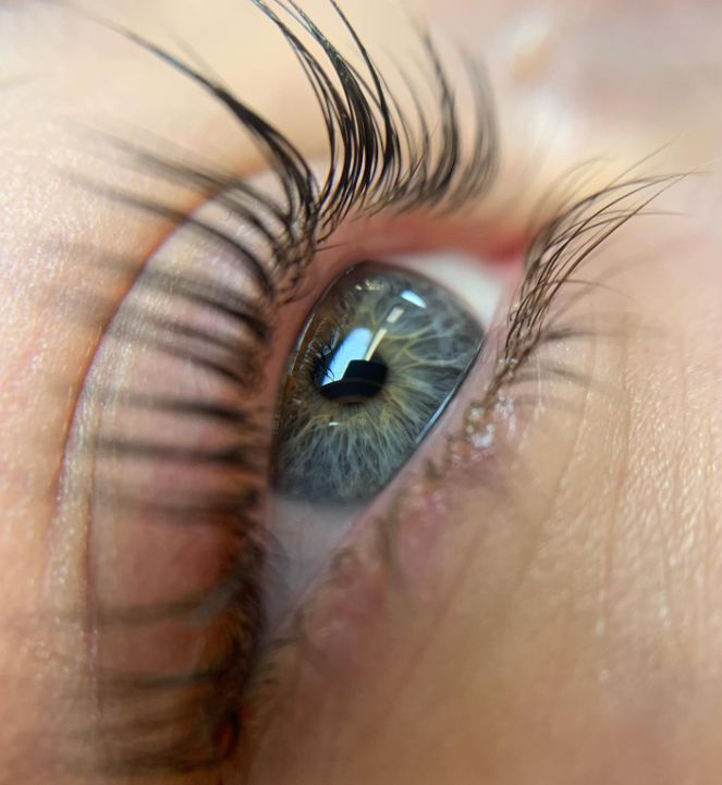 Pleonektímata tou anórthosis vlefarídon