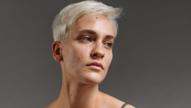 Τα Καλύτερα Σέρουμ Προσώπου Κατά των Κοκκινίλων & Καταπραϋντικά που έχω Δοκιμάσει και σας Προτείνω